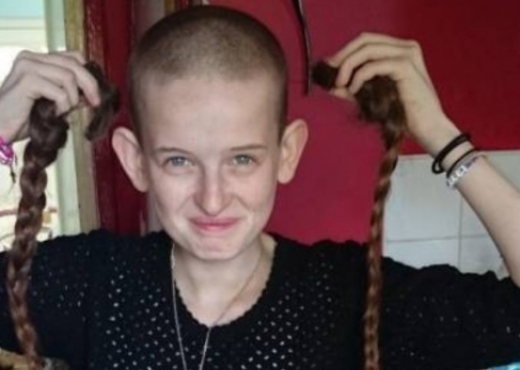 wear wig sex girl bald shaved head Headache facial burning